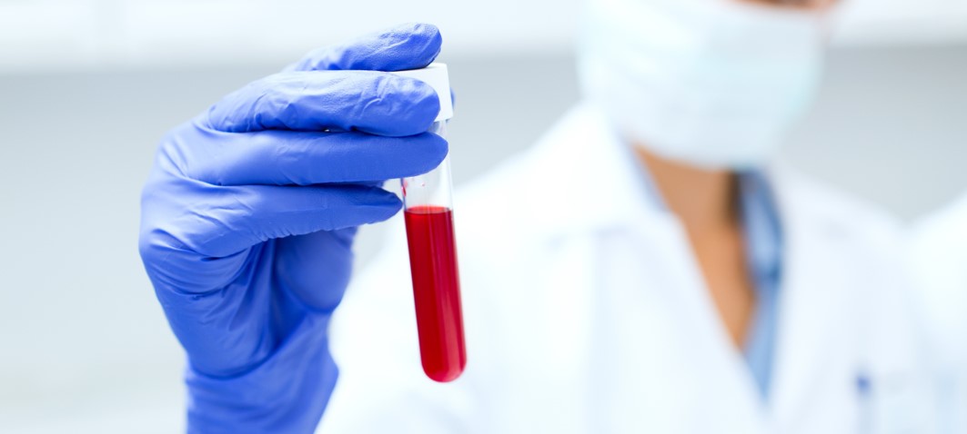 Every Drop Counts: Saving Lives with Innovative Blood Diagnostic Technologies